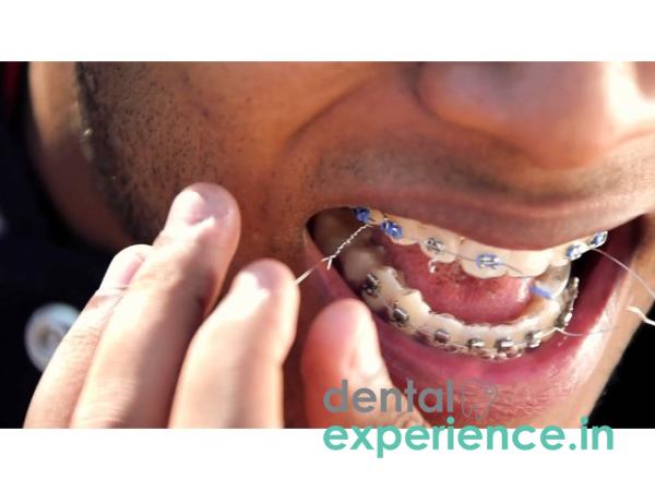 Broken Braces or Orthodontic Appliances(Emergency )